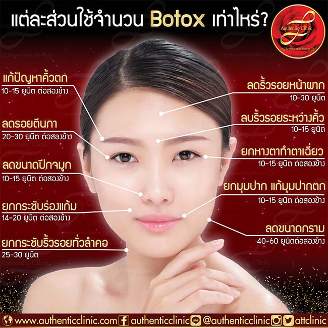 Botox