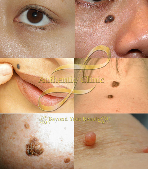 Miracle Perfect Skin 02