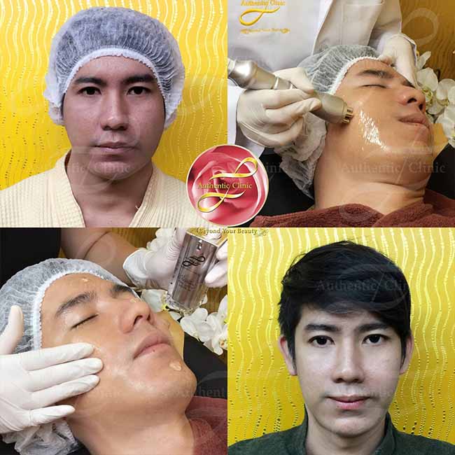 Review Miracle Facial Design web