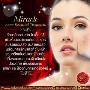 Miracle-Acne-Essential-Treatment