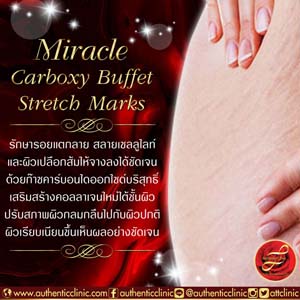 Miracle-Carboxy-Buffet-Stretch-Marks