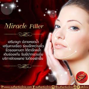 Miracle-Filler