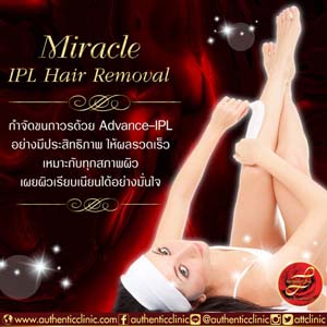 Miracle-IPL-Hair-Removal