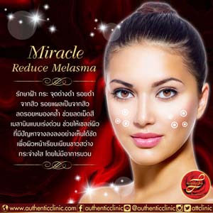 Miracle-Reduce-Melasma