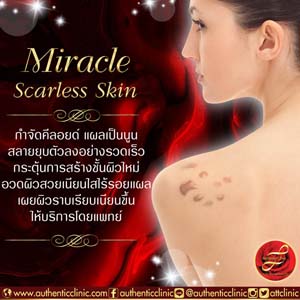 Miracle-Scarless-Skin