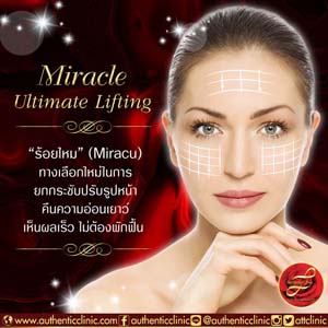 Miracle-Ultimate-Lifting