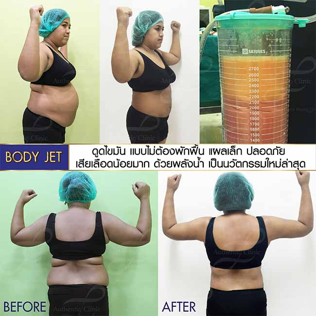 Review body jet web