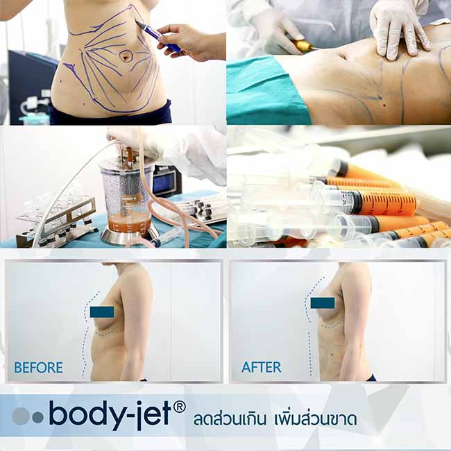 Review body jet3 web