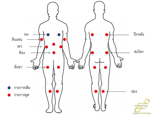 บริเวณที่สามารถเติม-ดูด ไขมันได้ web