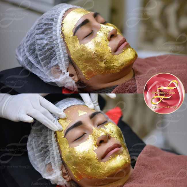 Review Miracle Golden Mask